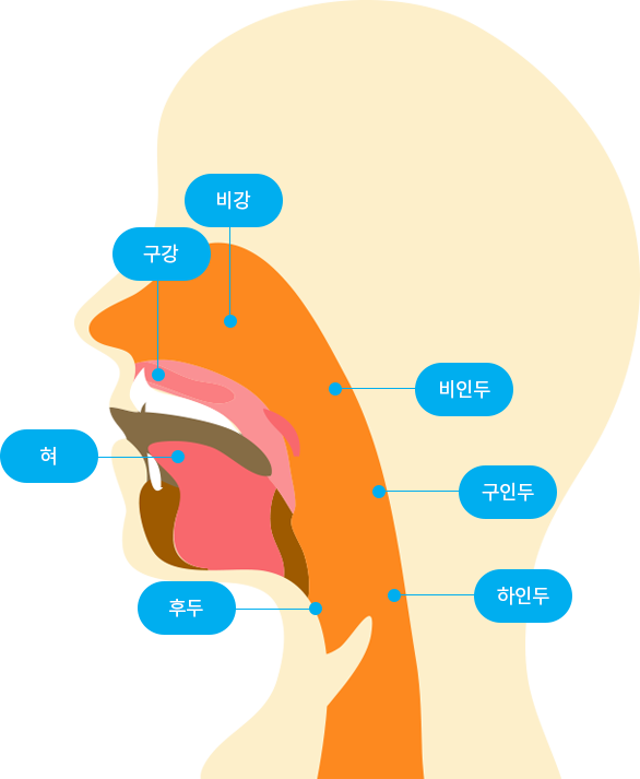 두경부암 발생부위 표시 이미지